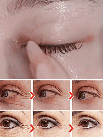 👁️✨ LUTEIN EYE CARE SERUM – BRIGHTER, FRESHER EYES DAILY! ✨👁️