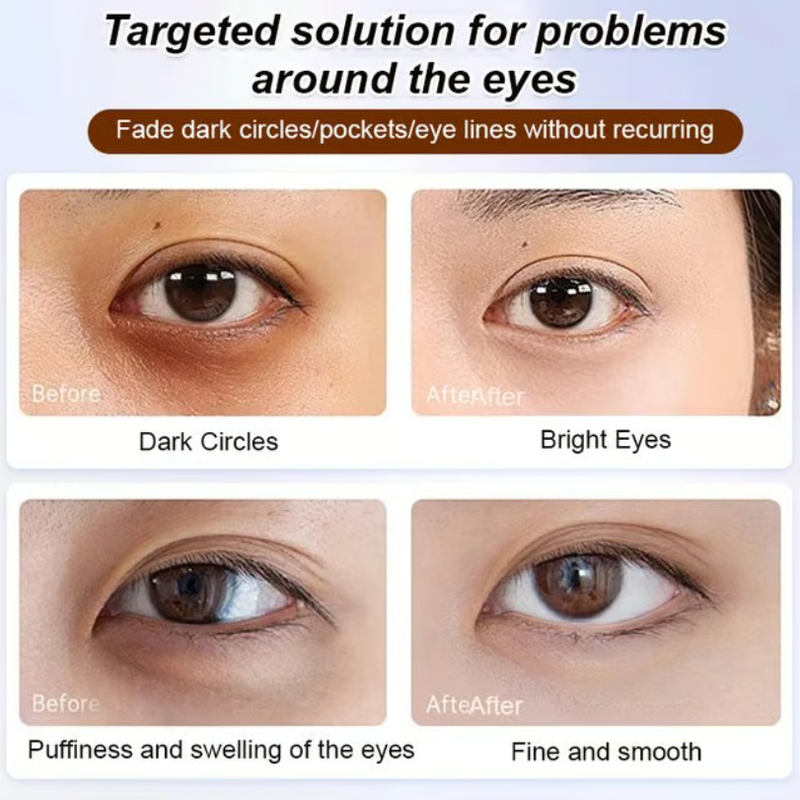 👁️✨ LUTEIN EYE CARE SERUM – BRIGHTER, FRESHER EYES DAILY! ✨👁️